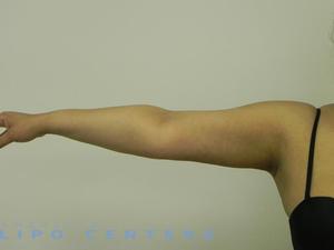 americanlipocenters_38.jpg